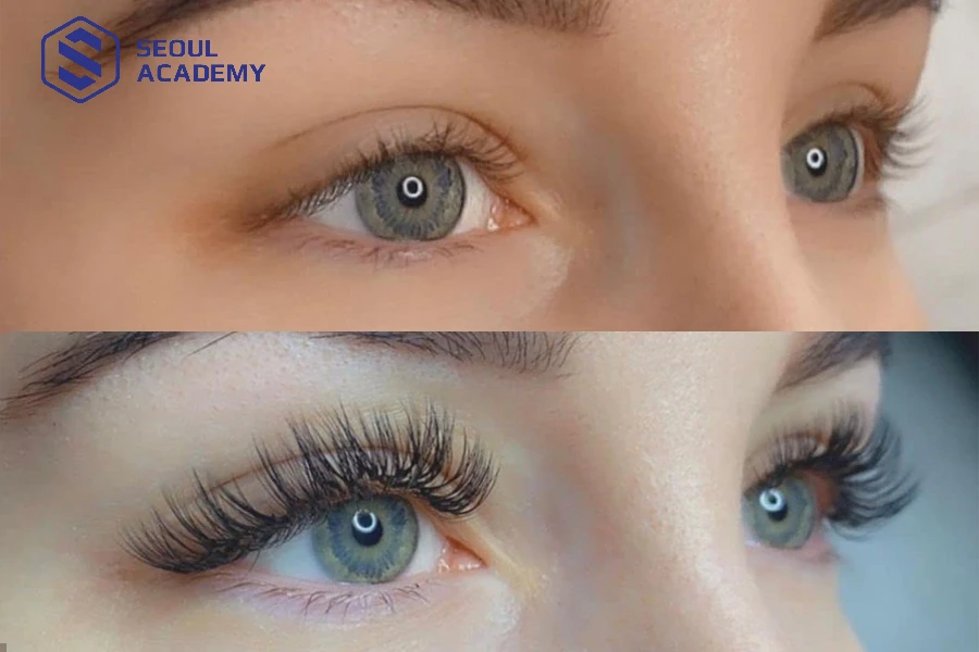 Thời gian nối mi phụ thuộc vào nhiều yếu tố