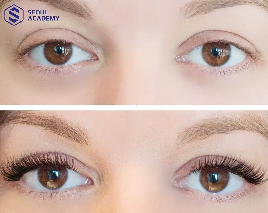 Nối mi cáo có thể ứng dụng cho nhiều trường hợp khác nhau