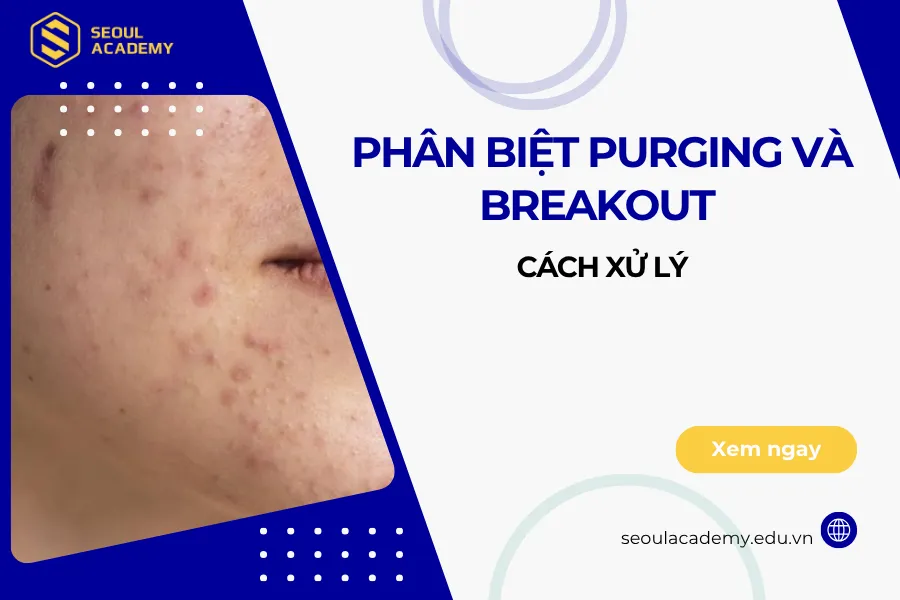 Phân biệt purging và breakout và cách xử lý