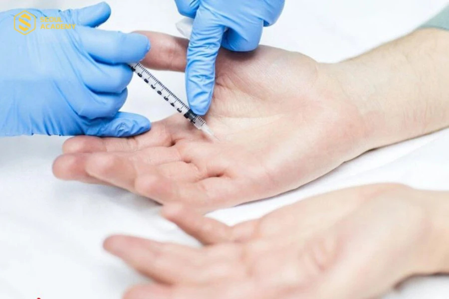 Tiêm botox giúp trị mồ hôi tay khoảng 4 - 6 tháng