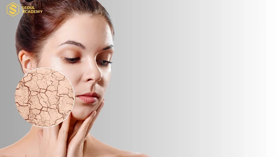 Làn da khô dễ bị căng tức, bong tróc và lão hóa sớm