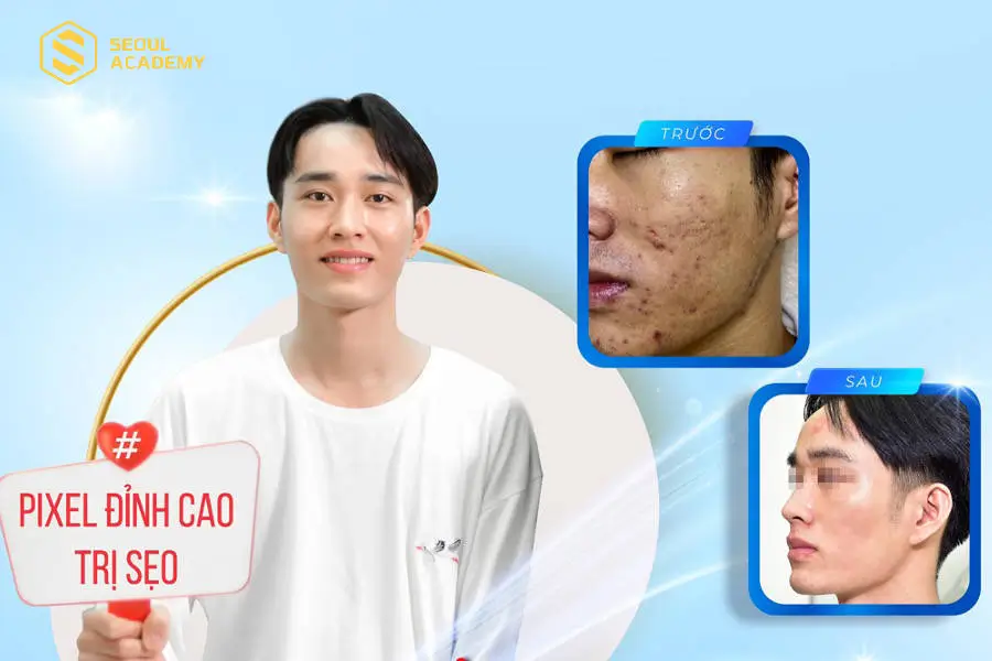 Phòng khám Da liễu HHV Clinic cung cấp nhiều gói Spa da mặt nam chất lượng