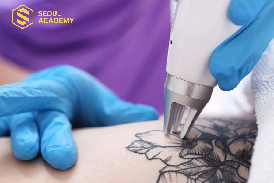 Nghề xóa xăm phù hợp với nhiều đối tượng