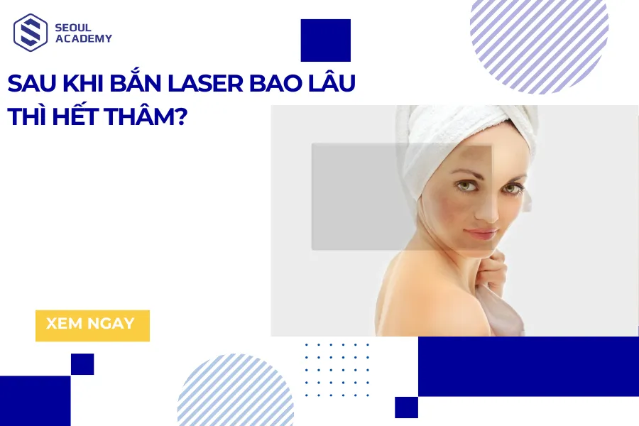 Sau khi bắn laser bao lâu thì hết thâm