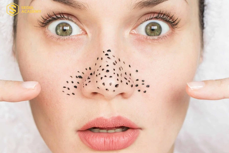 Tránh mắc phải những thói quen xấu có thể khiến tình trạng da tồi tệ hơn