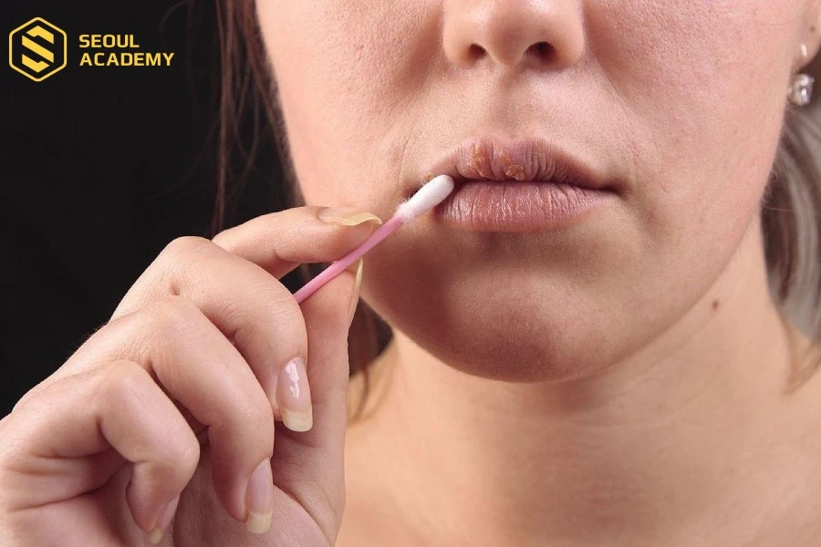 Vệ sinh môi đúng cách với tăm bông