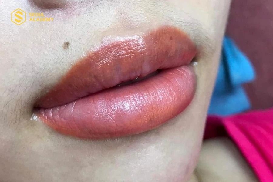 Hình ảnh môi không đều màu sau phun môi