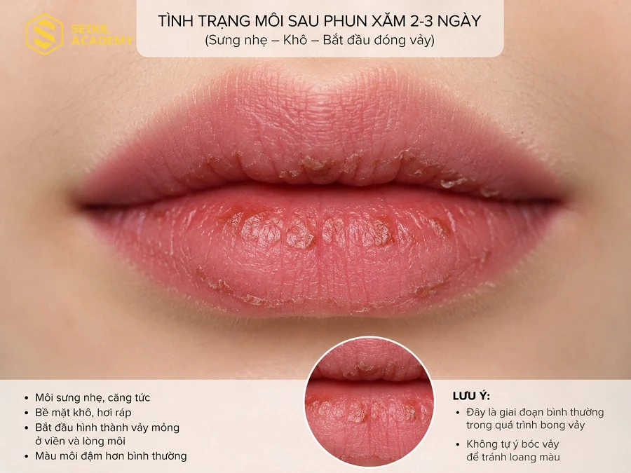 Môi bắt đầu sưng nhẹ và đóng vảy trong thời gian đầu sau phun xăm