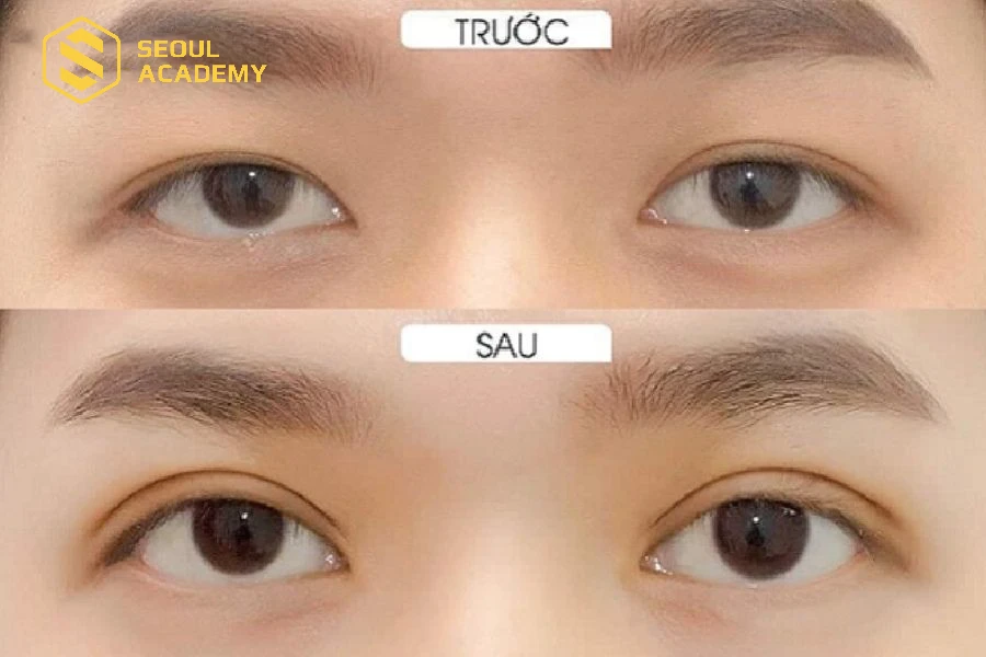 Thành phẩm của học viên thực hiện thành công kỹ thuật cắt mí