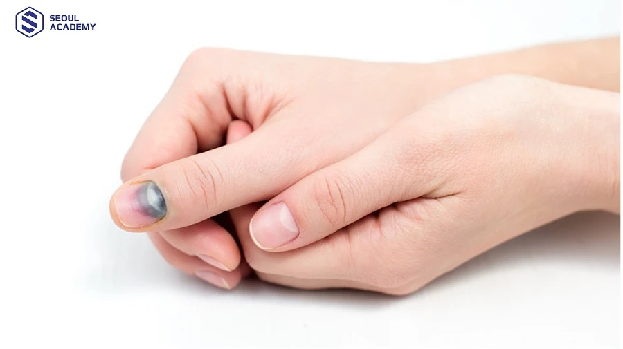 Bị dập móng không nên làm nail liền, thay vào đó cần để thời gian hồi phục sức khỏe của móng