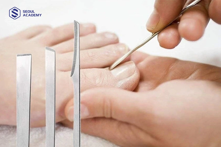 Cách lấy khoé chân sâu tại nhà bằng cây lấy khóe chuyên dụng