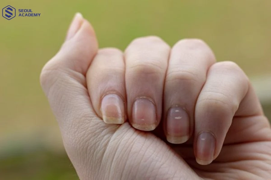Đắp bột và sơn gel có mức độ ảnh hưởng đến móng khác nhau