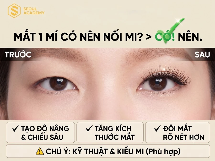 Mắt 1 mí có nên nối mi không