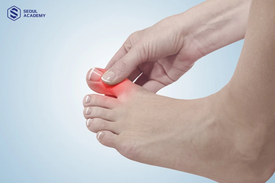 Nên chăm sóc kỹ khi móng chân bị va chạm mạnh