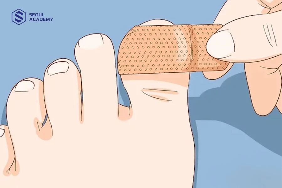 Xử lý vết thương ngay khi bật móng tại nhà là bước đầu để móng chân không bị nặng hơn
