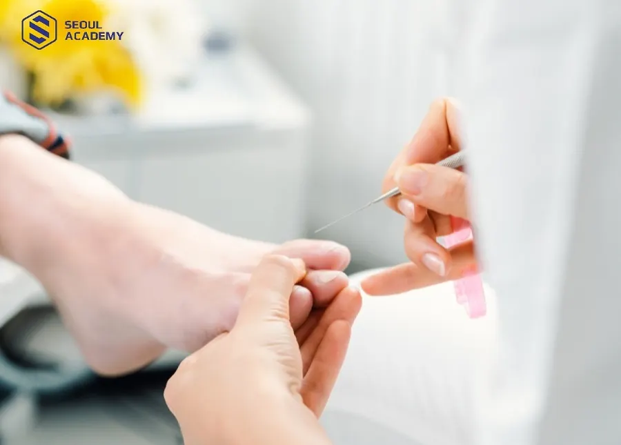 Khóe móng chân là nơi tích tụ nhiều vi khuẩn, bụi bẩn cần được làm sạch định kỳ