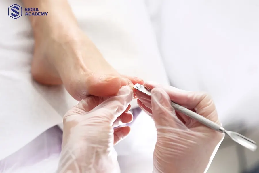 Chăm sóc móng đúng cách sau khi lấy khóe móng chân tại nhà