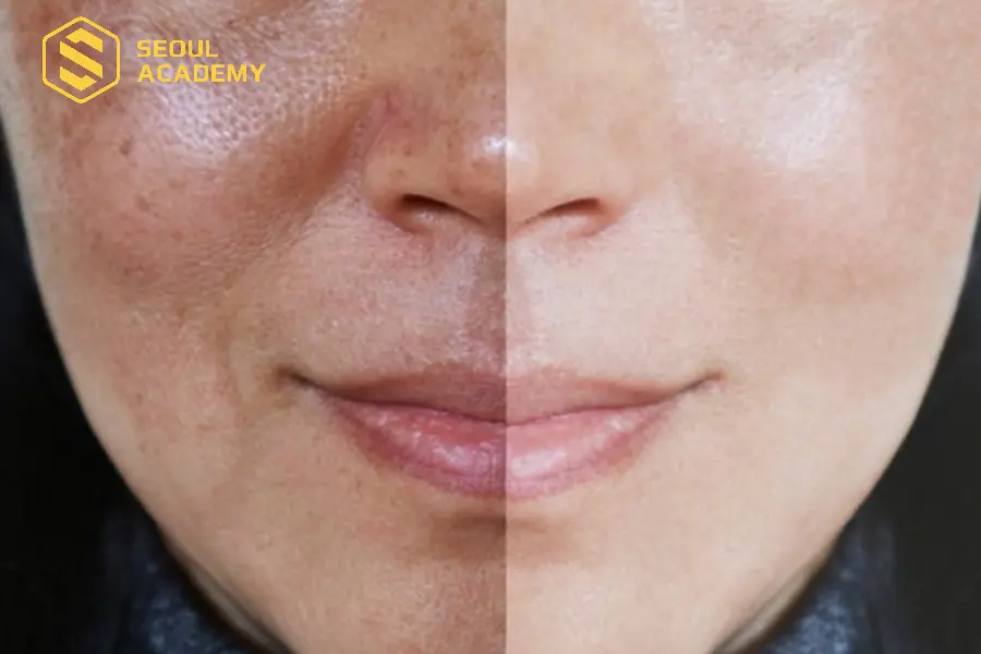 Sắc tố rất quan trọng với một làn da
