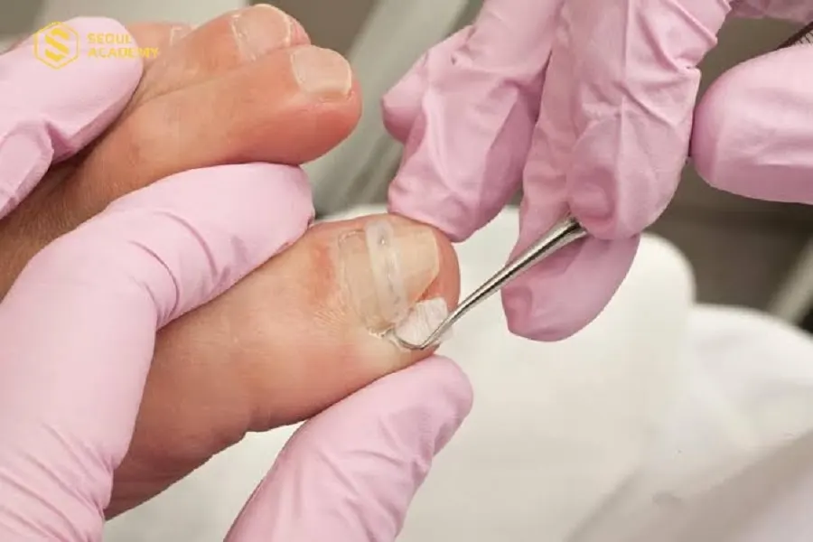 Cần đến thăm khám bởi bác sĩ da liễu nếu vết thương không thuyên giảm