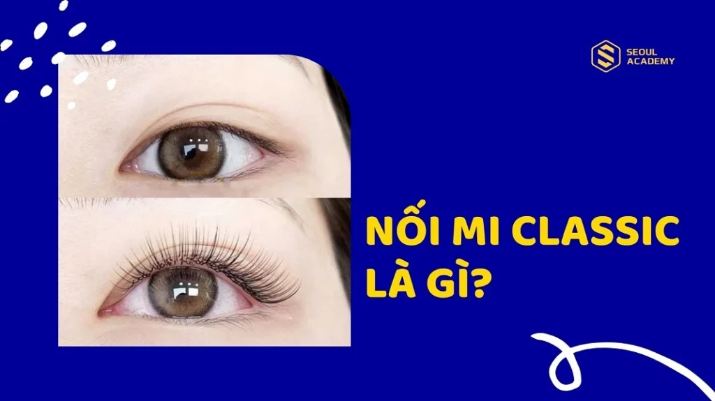 Nối mi classic là gì?