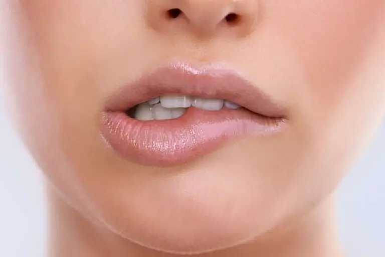 Cắn môi sẽ khiến máu bầm tích tụ dưới da và là nguyên nhân gây ra đốm đen