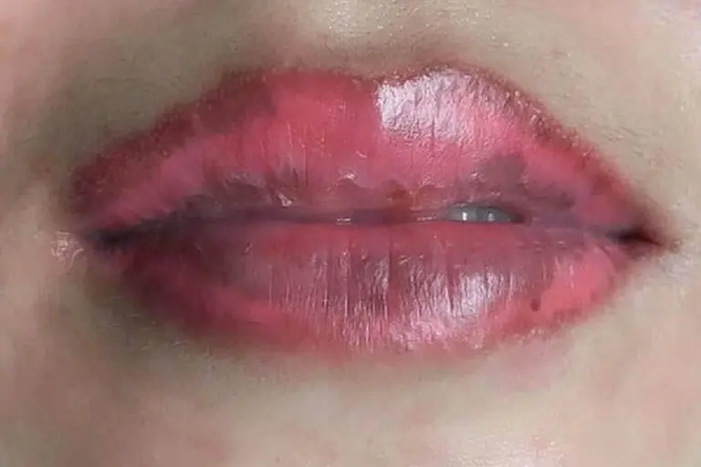 Phun môi bị đốm đen kèm nứt nẻ, loang lổ màu là dấu hiệu của việc bị khô