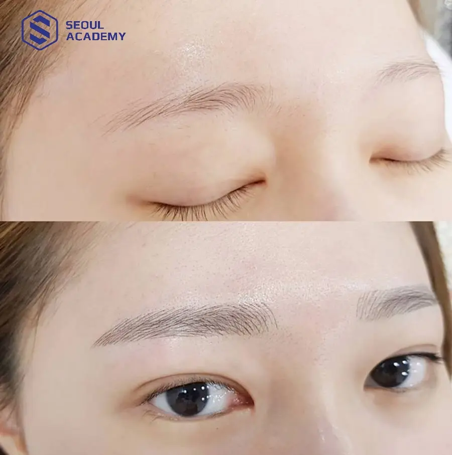 Điêu khắc chân mày bị lệch hoàn toàn có thể khắc phục được