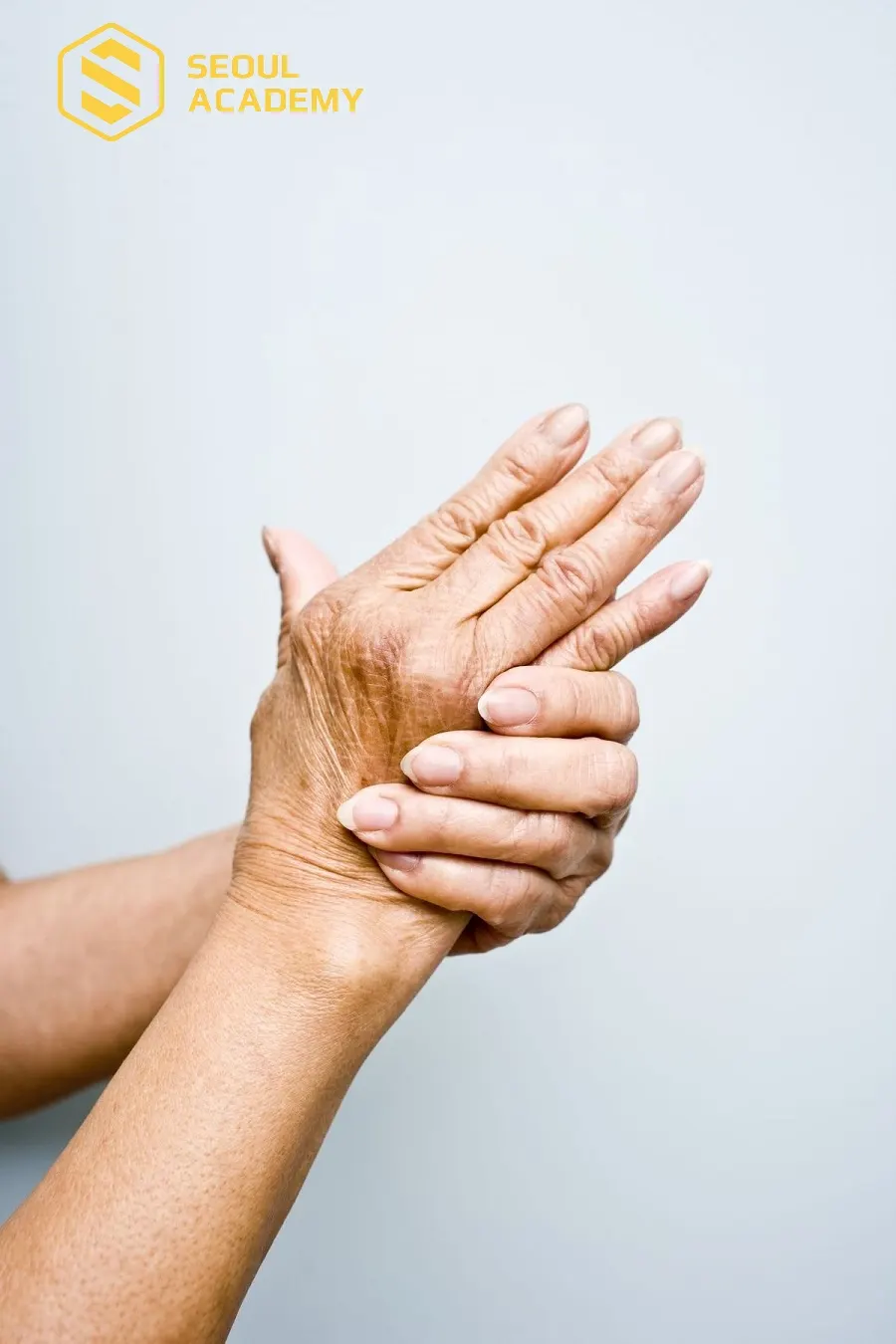 Bàn tay nhăn nheo, lão hóa sớm có thể xuất phát từ nhiều nguyên nhân khác nhau