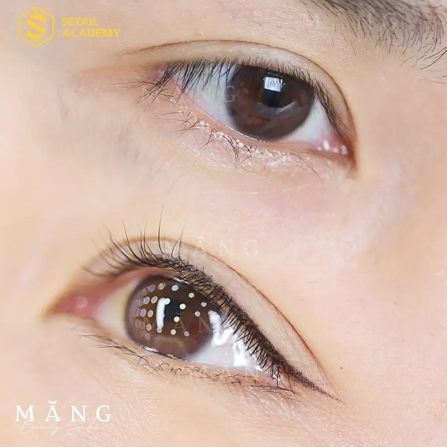 Chăm sóc mí mắt đúng cách để đảm bảo hiệu quả thẩm mỹ như mong đợi