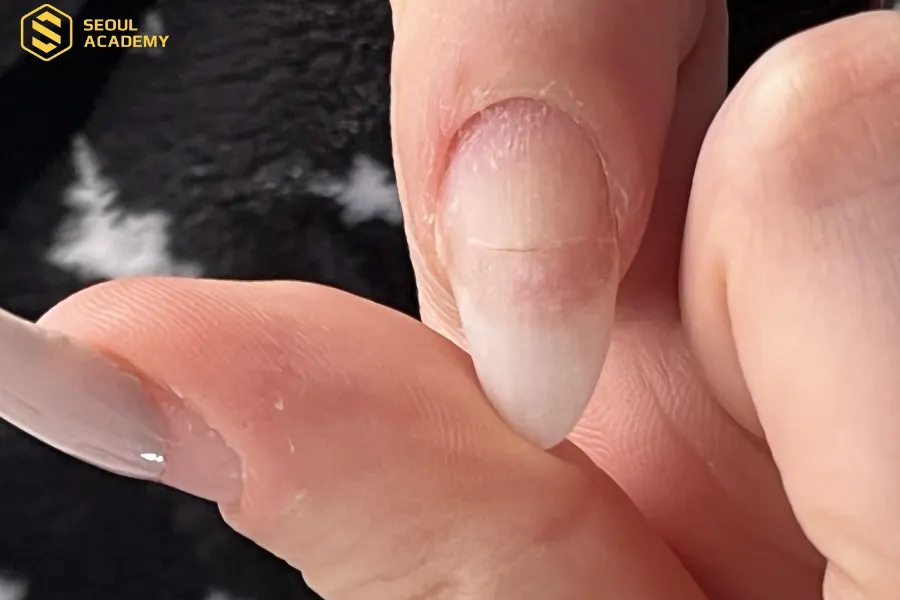 Làm móng nhiều là nguyên nhân phổ biến làm móng yếu và dễ nứt