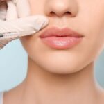 Nên phun môi hay cấy môi sinh học