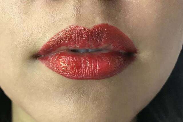 Hình ảnh thực tế tình trạng môi bị lem viền, vệt mực loang ra khỏi khuôn môi tự nhiên gây mất thẩm mỹ