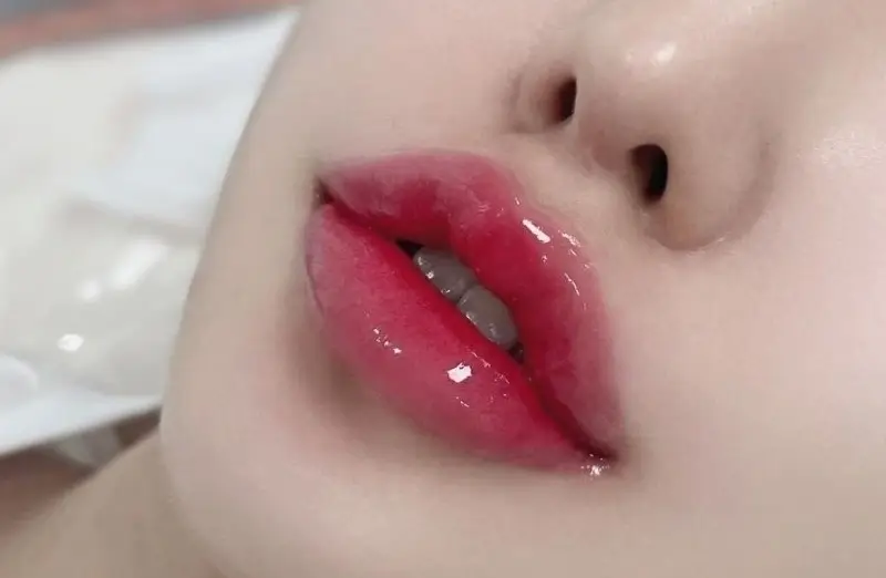 Tùy vào nhu cầu và tình trạng môi mà có thể lựa chọn phương pháp cải thiện sắc môi phù hợp