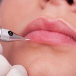 Kỹ thuật phun môi với NanoCell Plasma thích hợp cho khách hàng muốn cải thiện khuyết điểm trên môi