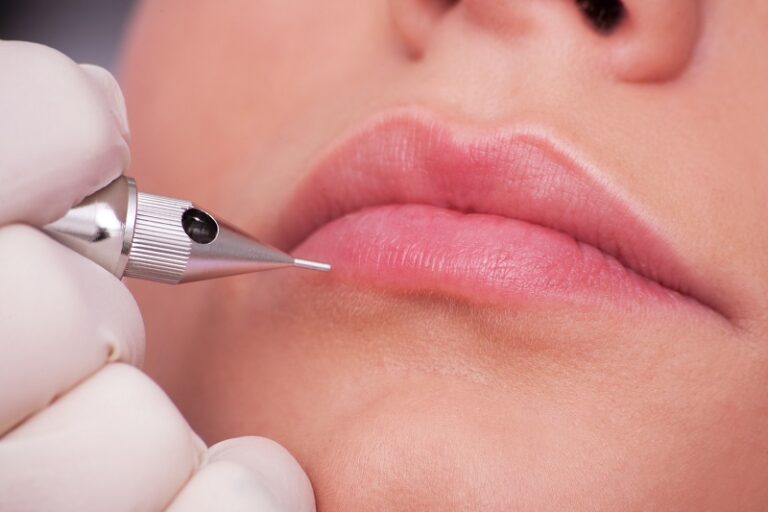 Kỹ thuật phun môi với NanoCell Plasma thích hợp cho khách hàng muốn cải thiện khuyết điểm trên môi
