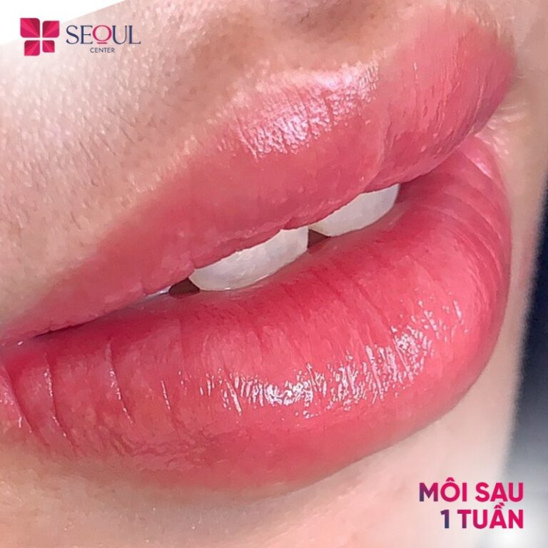Phun môi NanoCell Plasma giúp bạn sở hữu đôi môi đỏ mọng, quyến rũ
