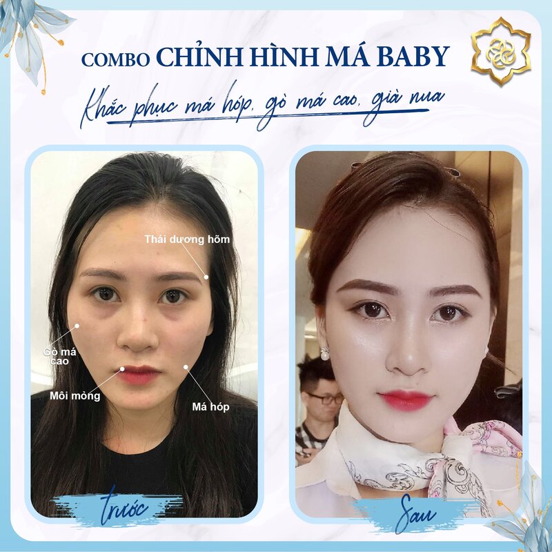 Thẩm mỹ viện Sunny giúp bạn sở hữu vẻ ngoài toàn diện hơn