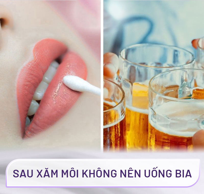 Giải đáp thắc mắc xăm môi có được uống bia không và thời gian kiêng cữ đồ uống có cồn giúp môi mau lành, lên màu chuẩn sắc
