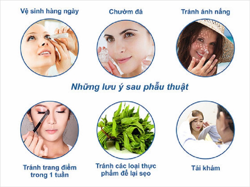 Cần lưu ý việc chăm sóc sau cắt mí để cơ thể hồi phục nhanh chóng