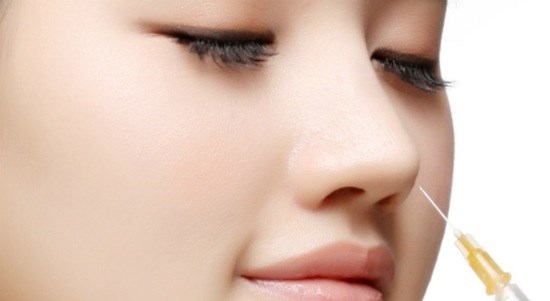 Tiêm filler mũi là gì | Giữ được bao lâu? | Nên làm ở đâu?