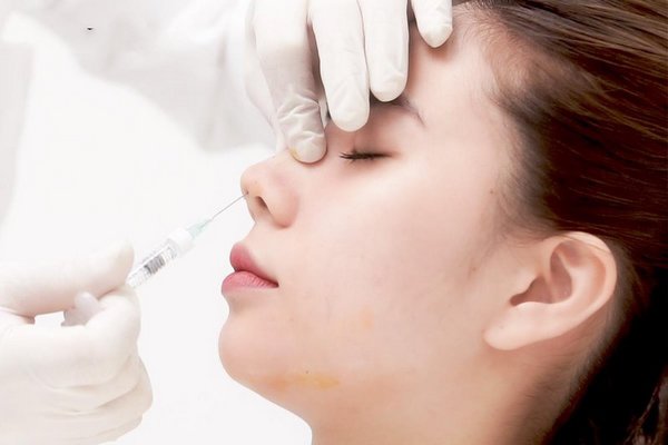 Tiêm filler nâng mũi không đau, không để lại sẹo