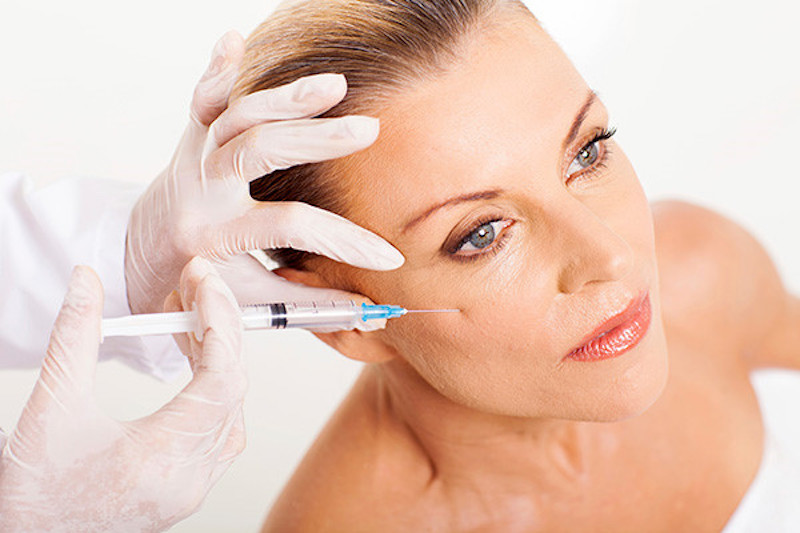 Tổng hợp các loại filler an toàn và hiệu quả khi sử dụng