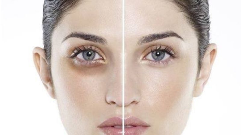 Mắt sâu nói lên điều gì?