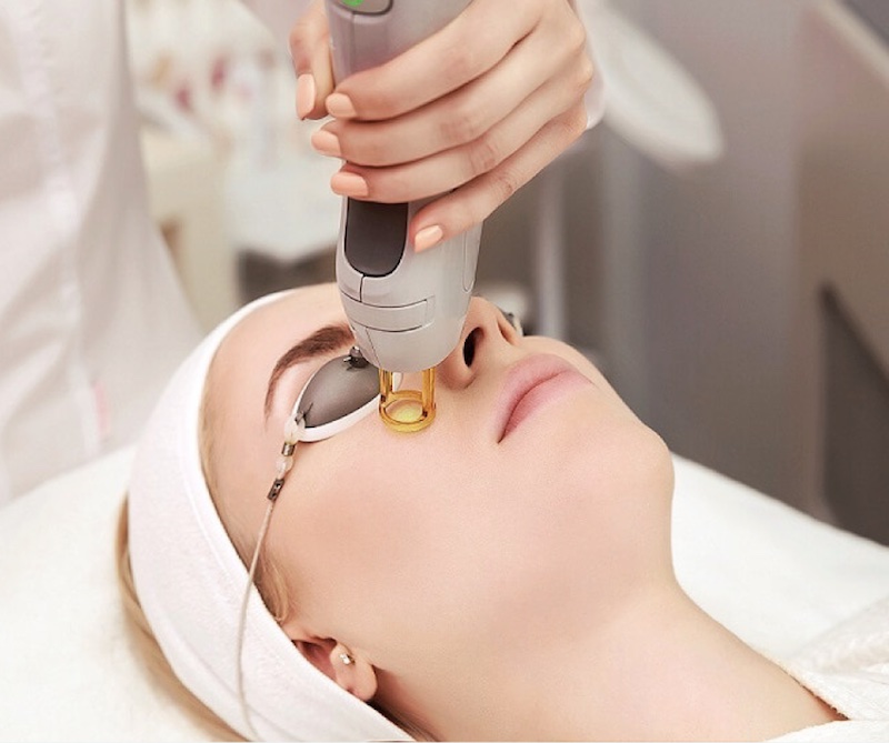 Nếu bạn muốn có được kết quả trị sẹo sau phẫu thuật nhanh chóng thì nên lựa chọn thực hiện các công nghệ thẩm mỹ