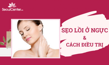 sẹo lồi ở ngực