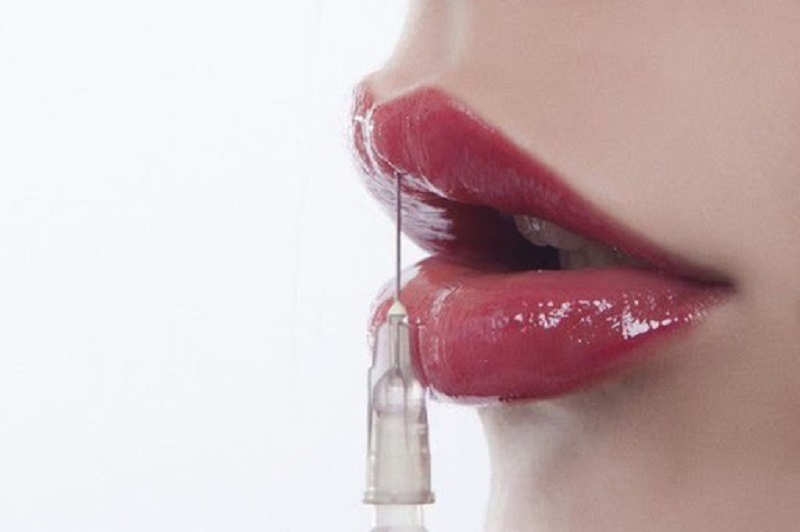 Nên tiêm filler môi ở những nơi uy tín để có được kết quả tốt, hạn chế biến chứng