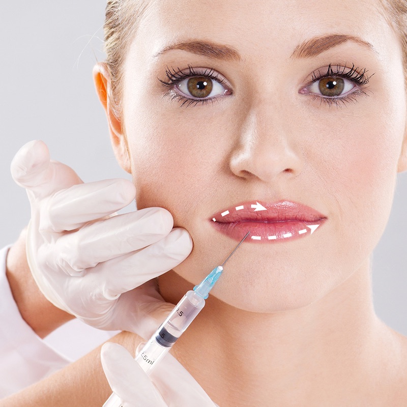 Tránh việc tác động mạnh vào môi sau khi tiêm filler