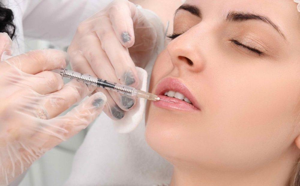 Sau khi tiêm filler môi cần đặc biệt chú ý trong 7 ngày đầu