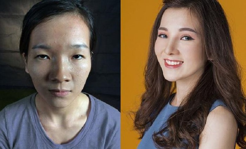 Cô gái có mắt lươn thay đổi mình để gạt bỏ định kiến Cô gái có mắt lươn thay đổi mình để gạt bỏ định kiến