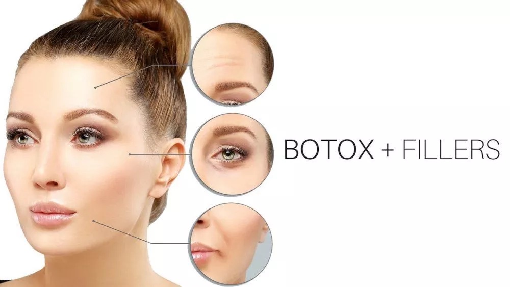 Tiêm filler hay tiêm botox tốt hơn tuỳ thuộc vào mục đích tiêm của bạn